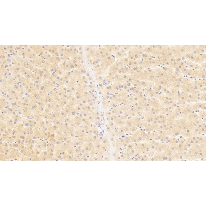 2',5'-Oligoadenylate Synthetase 1 (OAS1) Human Monoclonal Antibody