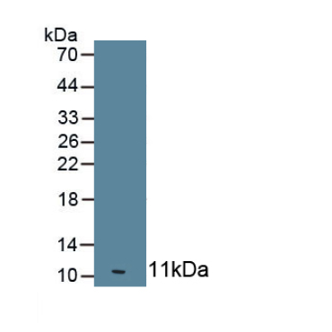 2',5'-Oligoadenylate Synthetase 1 (OAS1) Human Monoclonal Antibody
