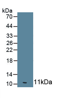 2',5'-Oligoadenylate Synthetase 1 (OAS1) Human Monoclonal Antibody