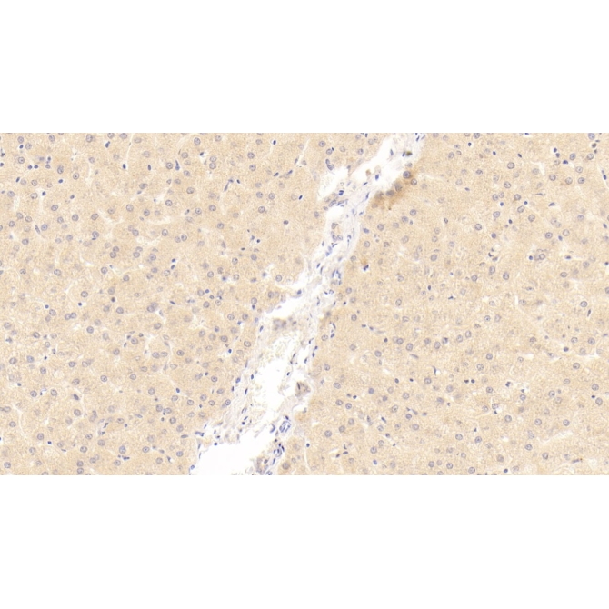 2',5'-Oligoadenylate Synthetase 1 (OAS1) Human Monoclonal Antibody