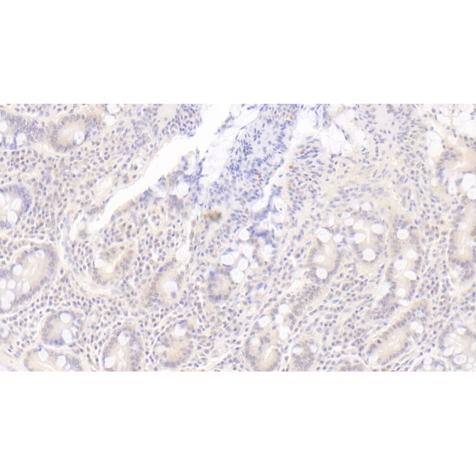 2',5'-Oligoadenylate Synthetase 1 (OAS1) Human Monoclonal Antibody