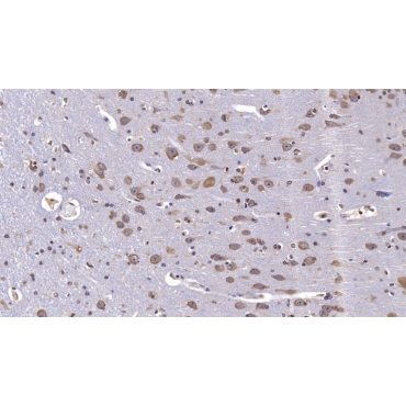 Reelin (RELN) Human Monoclonal Antibody