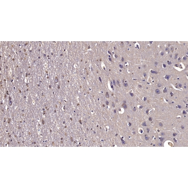 Reelin (RELN) Human Monoclonal Antibody