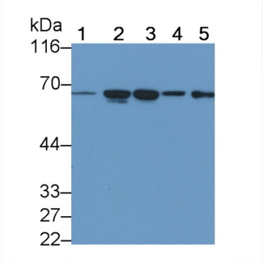 Transmembrane Protease, Serine 2 (TMPRSS2) Human Monoclonal Antibody