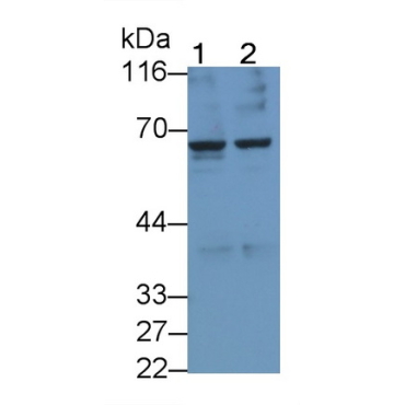 Transmembrane Protease, Serine 2 (TMPRSS2) Human Monoclonal Antibody
