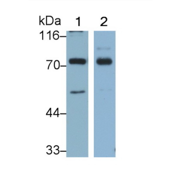 Tumor Protein P63 (TP63) Human Monoclonal Antibody