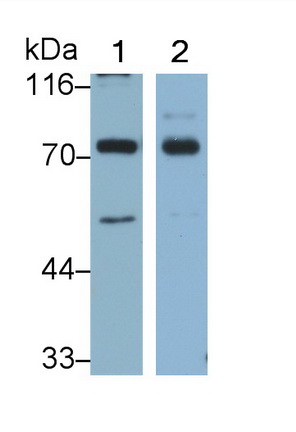 Tumor Protein P63 (TP63) Human Monoclonal Antibody