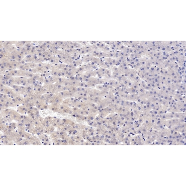 Thymidine Kinase 1, Soluble (TK1) Human Monoclonal Antibody