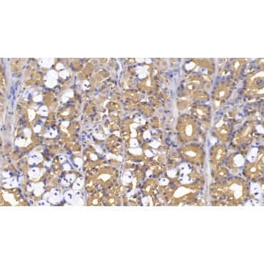 Thymidine Kinase 1, Soluble (TK1) Human Monoclonal Antibody