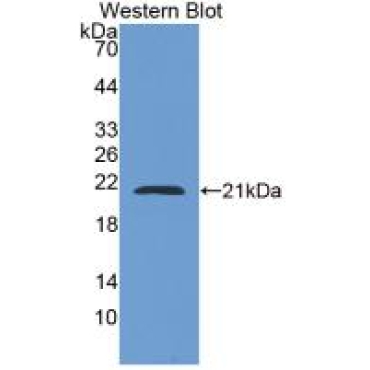 Adenylyl Cyclase Associated Protein 2 (CAP2) Human Monoclonal Antibody