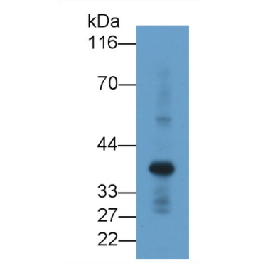 Renalase (RNLS) Human Monoclonal Antibody