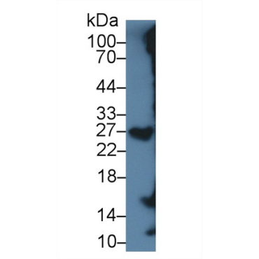 Serglycin (SRGN) Human Monoclonal Antibody
