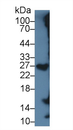 Serglycin (SRGN) Human Monoclonal Antibody
