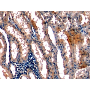 Stanniocalcin 1 (STC1) Human Monoclonal Antibody