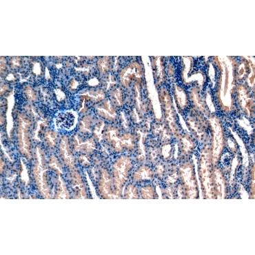 Stanniocalcin 1 (STC1) Human Monoclonal Antibody