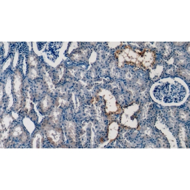 Stanniocalcin 1 (STC1) Human Monoclonal Antibody