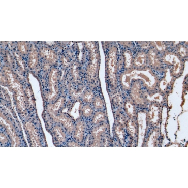 Stanniocalcin 1 (STC1) Human Monoclonal Antibody