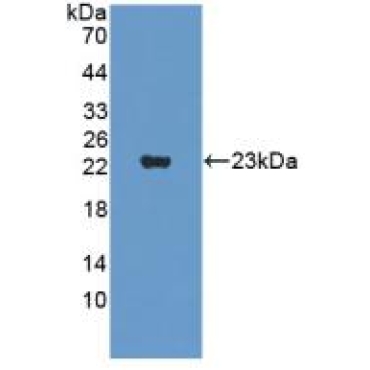 Supervillin (SVIL) Human Monoclonal Antibody