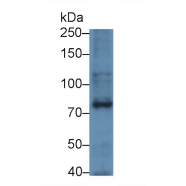 Serotonin Transporter (SERT) Human Monoclonal Antibody