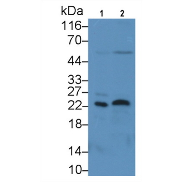 Fibroblast Growth Factor 13 (FGF13) Human Monoclonal Antibody