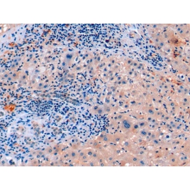 Fibroblast Growth Factor 21 (FGF21) Human Monoclonal Antibody
