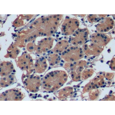 Fibroblast Growth Factor 21 (FGF21) Human Monoclonal Antibody