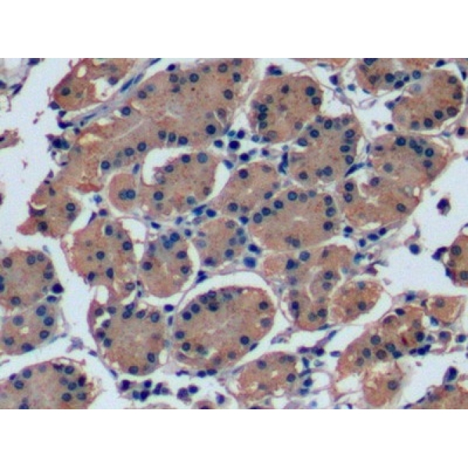 Fibroblast Growth Factor 21 (FGF21) Human Monoclonal Antibody