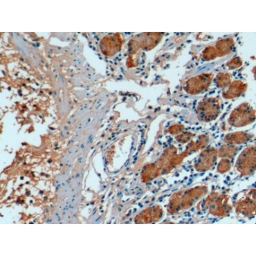 Fibroblast Growth Factor 21 (FGF21) Human Monoclonal Antibody