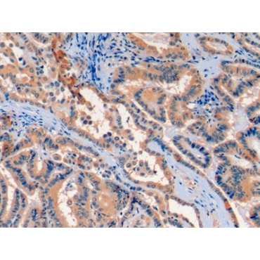 Fibroblast Growth Factor 21 (FGF21) Human Monoclonal Antibody