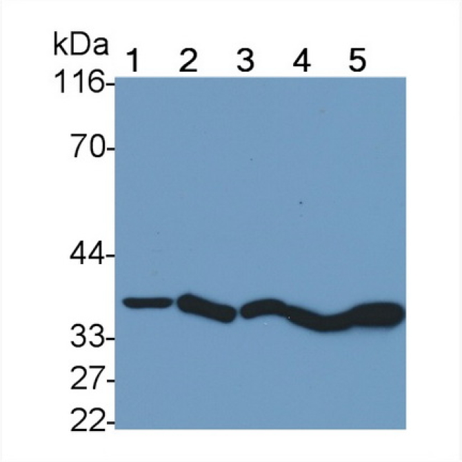Cathepsin B (CTSB) Human Monoclonal Antibody