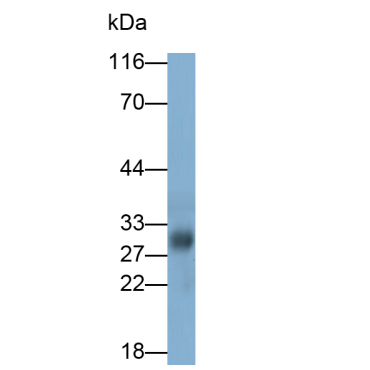 Cathepsin B (CTSB) Human Monoclonal Antibody