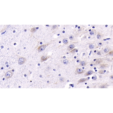 Cathepsin B (CTSB) Human Monoclonal Antibody