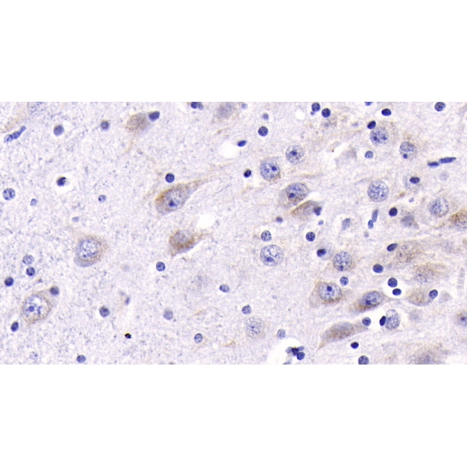 Cathepsin B (CTSB) Human Monoclonal Antibody