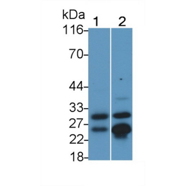Cathepsin B (CTSB) Human Monoclonal Antibody