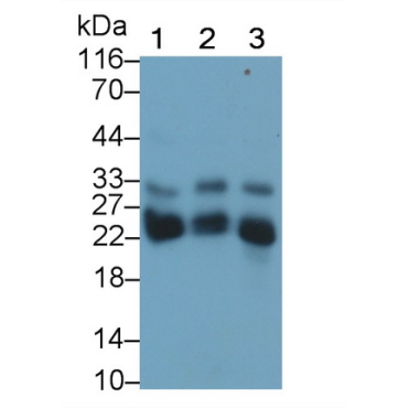 Cathepsin B (CTSB) Human Monoclonal Antibody