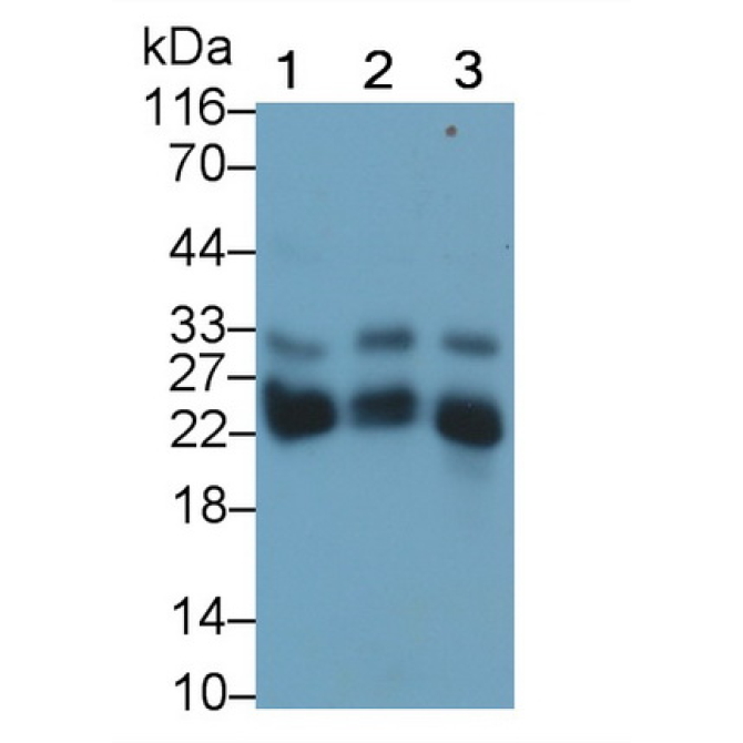 Cathepsin B (CTSB) Human Monoclonal Antibody