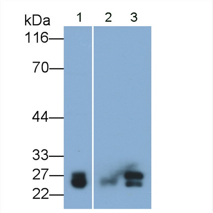 Cathepsin B (CTSB) Rat Monoclonal Antibody