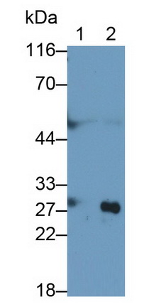 Cathepsin B (CTSB) Rat Monoclonal Antibody