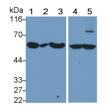 Carcinoembryonic Antigen Related Cell Adhesion Molecule 1 (CEACAM1) Human Monoclonal Antibody