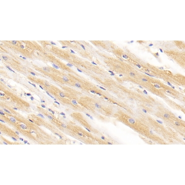 Arginyl tRNA Synthetase (RARS) Human Monoclonal Antibody