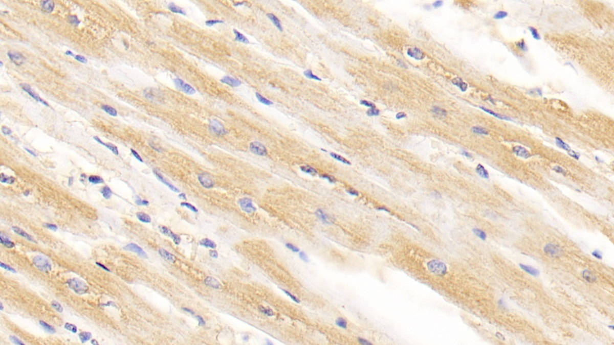 Arginyl tRNA Synthetase (RARS) Human Monoclonal Antibody