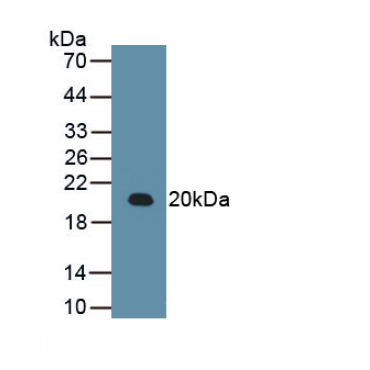 Arginyl tRNA Synthetase (RARS) Human Monoclonal Antibody