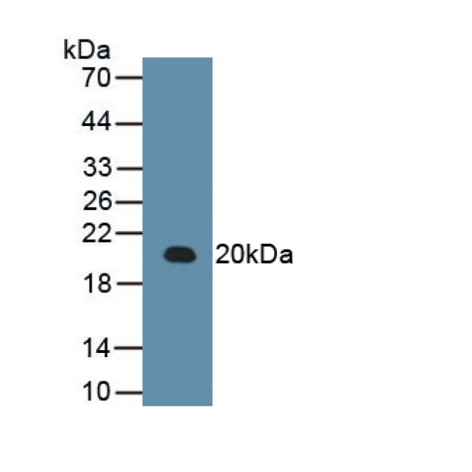 Arginyl tRNA Synthetase (RARS) Human Monoclonal Antibody