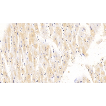 Arginyl tRNA Synthetase (RARS) Human Monoclonal Antibody