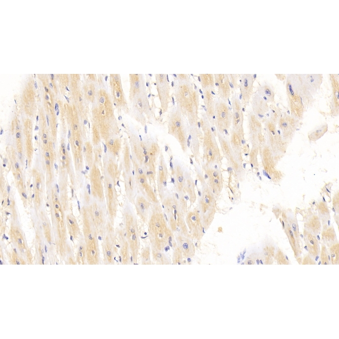 Arginyl tRNA Synthetase (RARS) Human Monoclonal Antibody