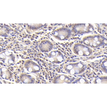 Arginyl tRNA Synthetase (RARS) Human Monoclonal Antibody