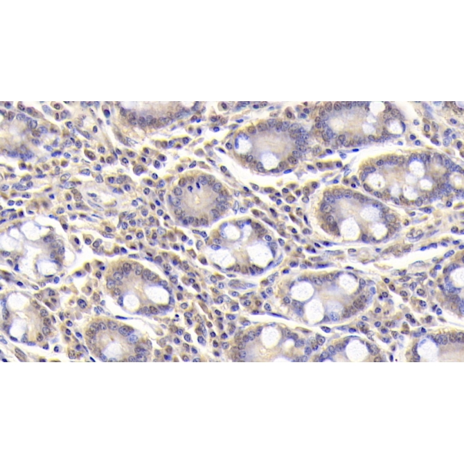 Arginyl tRNA Synthetase (RARS) Human Monoclonal Antibody