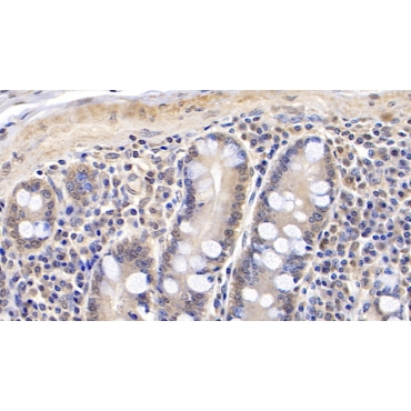 Arginyl tRNA Synthetase (RARS) Human Monoclonal Antibody