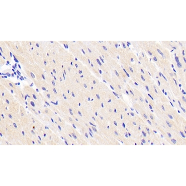 Arginyl tRNA Synthetase (RARS) Human Monoclonal Antibody