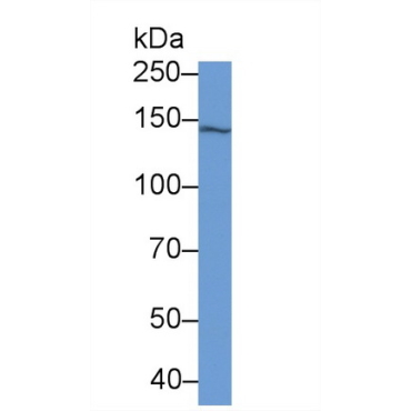 Isoleucyl tRNA Synthetase (IARS) Human Monoclonal Antibody